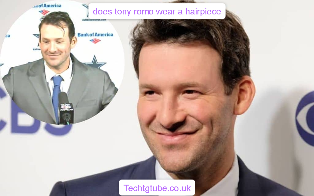 does tony romo wear a hairpiece