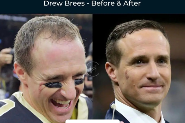 drew brees hair