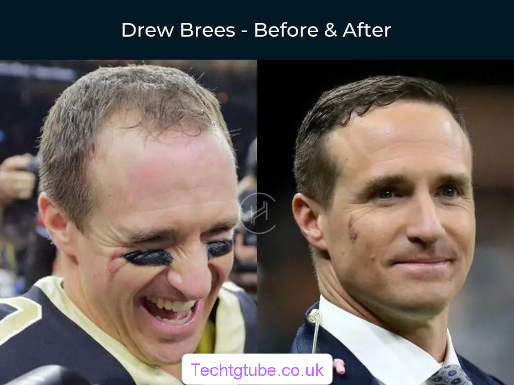 drew brees hair