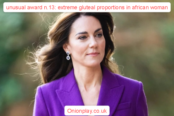 unusual award n.13: extreme gluteal proportions in african woman