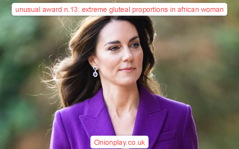 unusual award n.13: extreme gluteal proportions in african woman